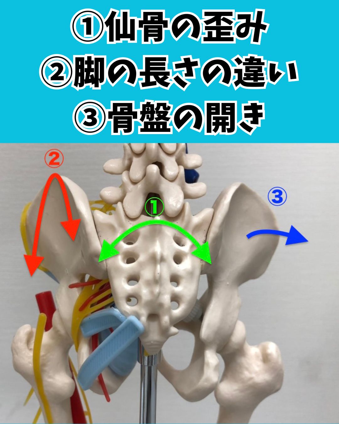 産後骨盤の歪み