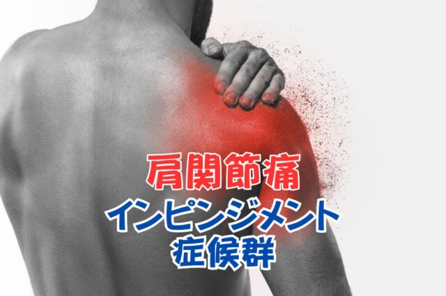 インピンジメント症候群