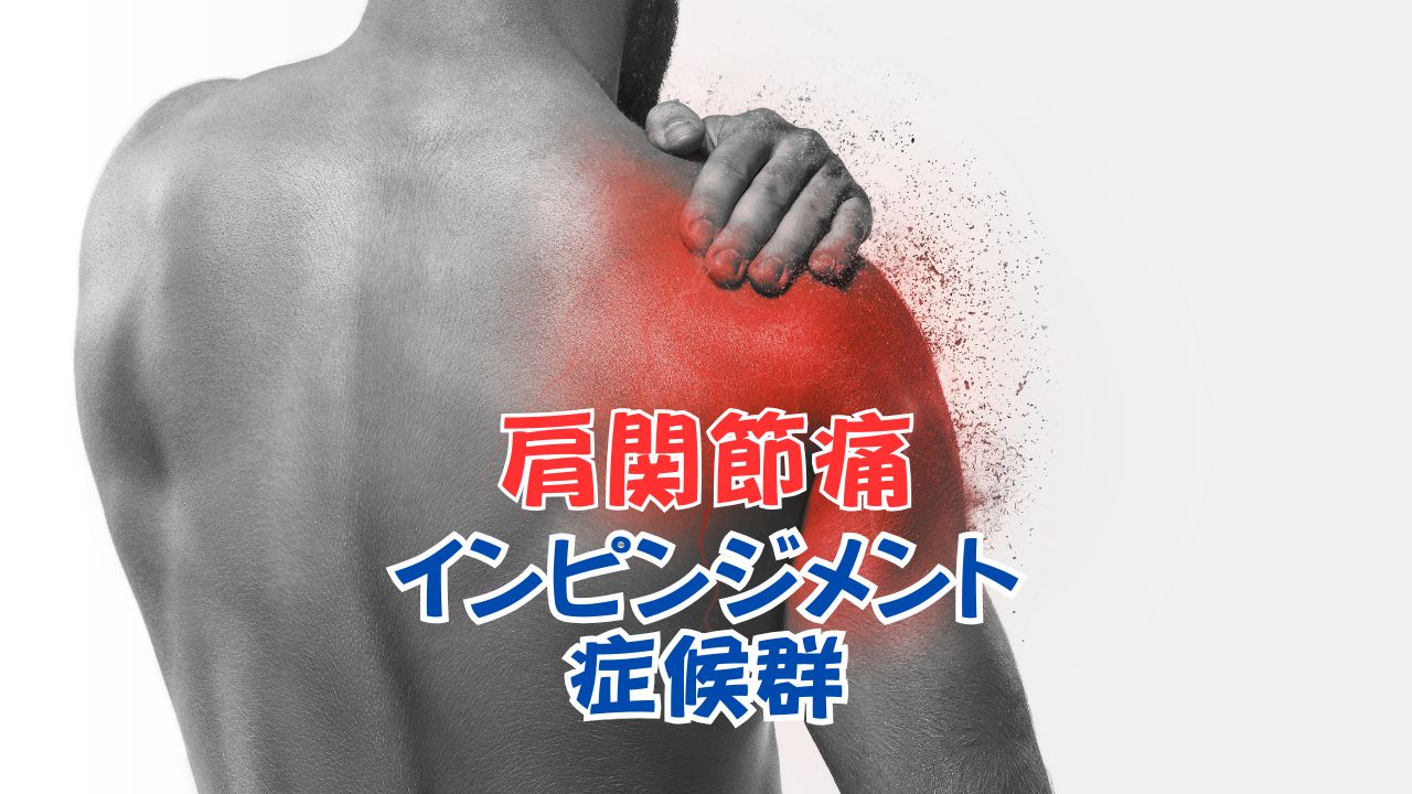 インピンジメント症候群