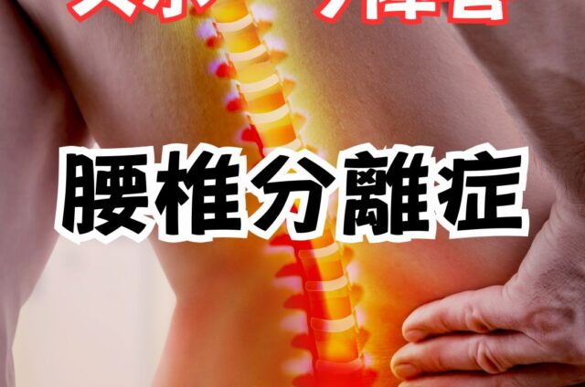 腰椎分離症　腰椎ぶんり症