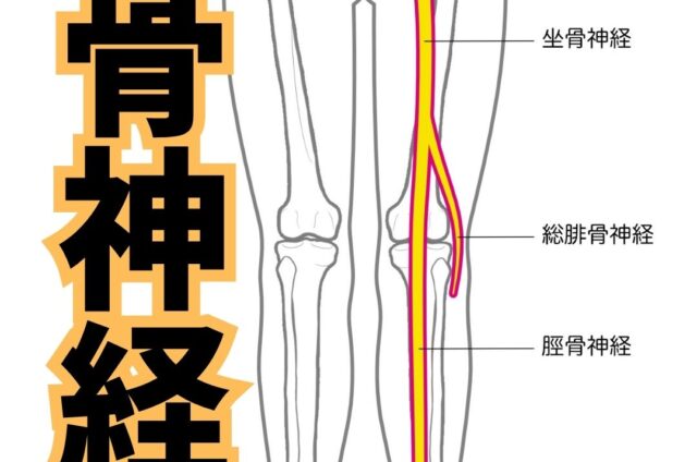 坐骨神経痛　坐骨神経痛とは
