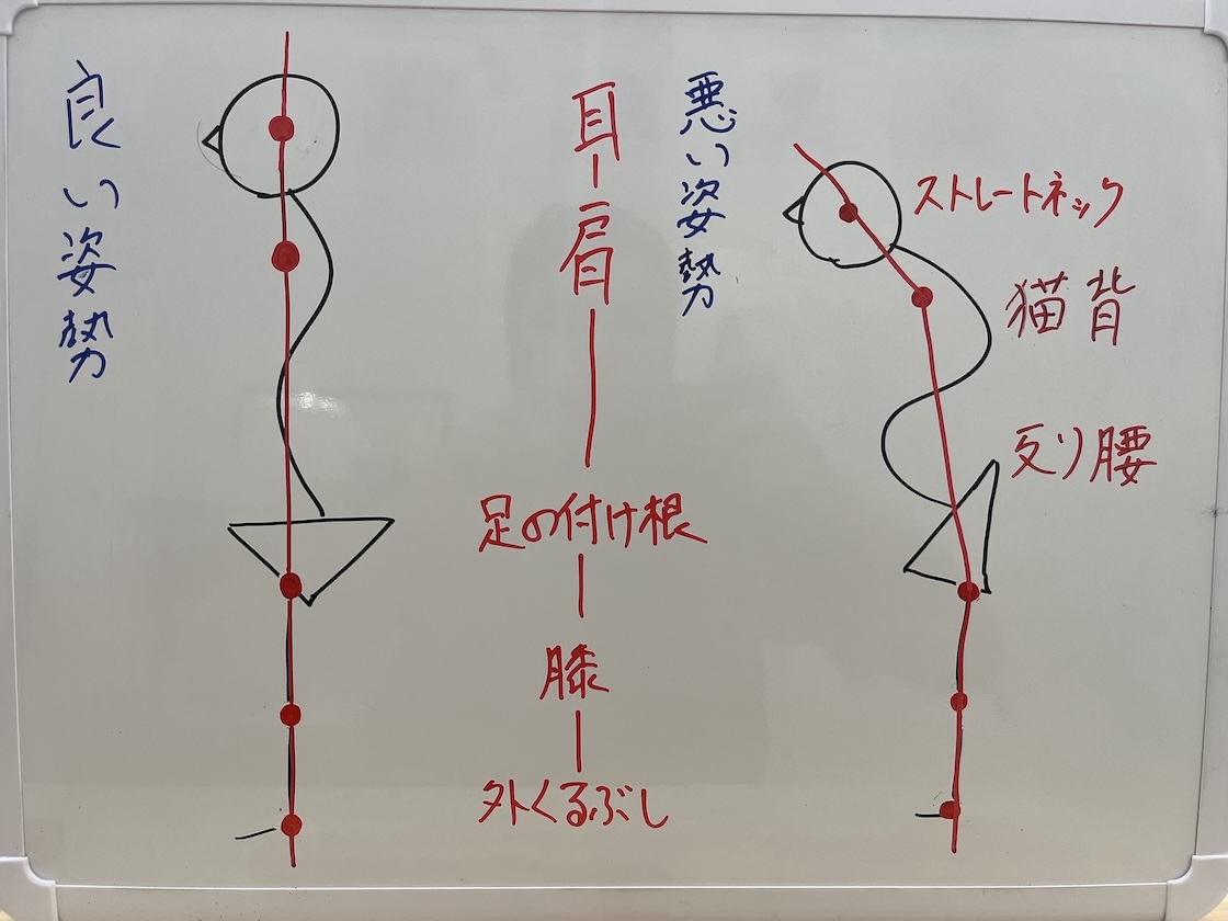 姿勢性腰痛　姿勢の乱れ