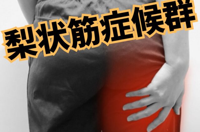 梨状筋症候群　お尻からの痛み