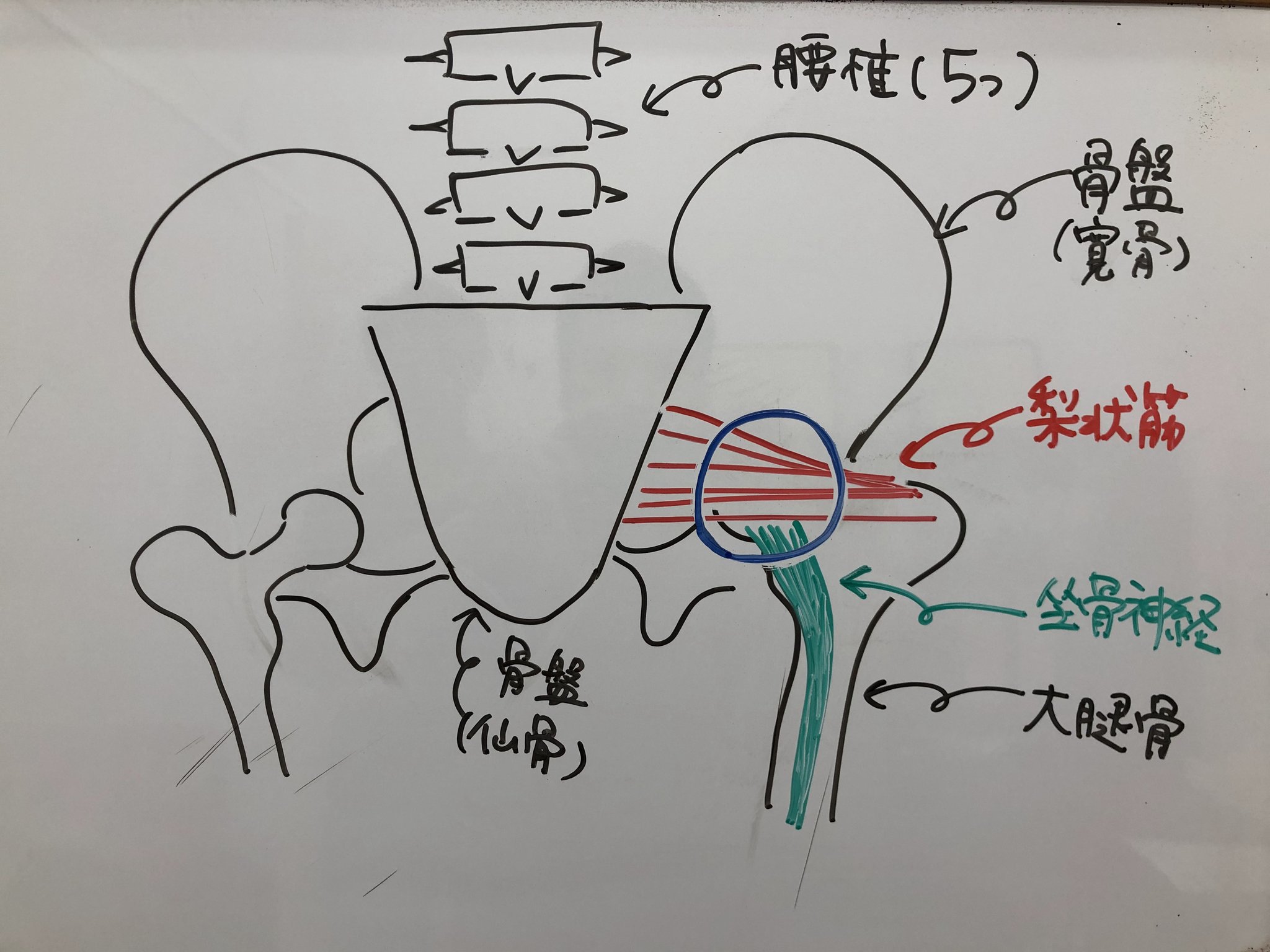 梨状筋症候群　骨盤