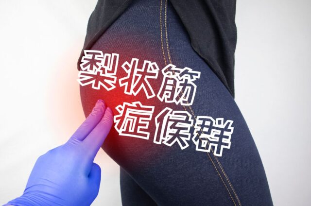 梨状筋症候群　梨状筋