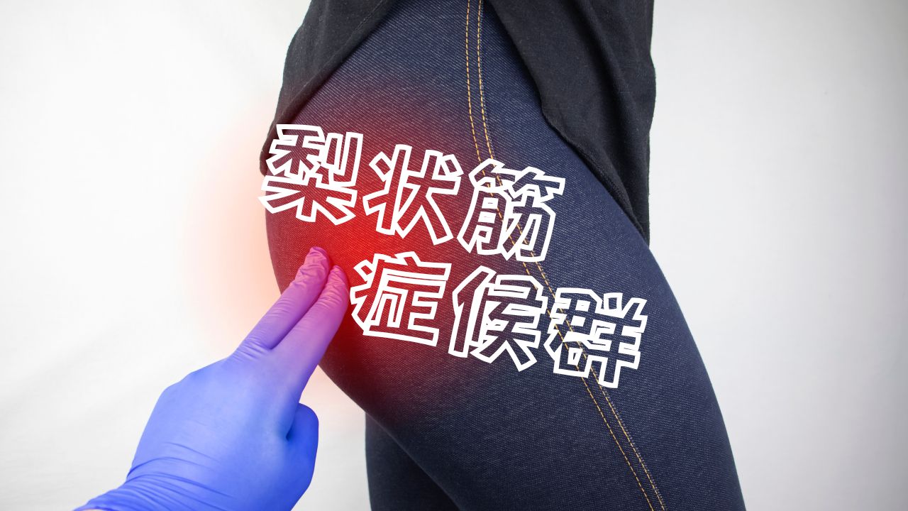 梨状筋症候群　筋肉の硬さ