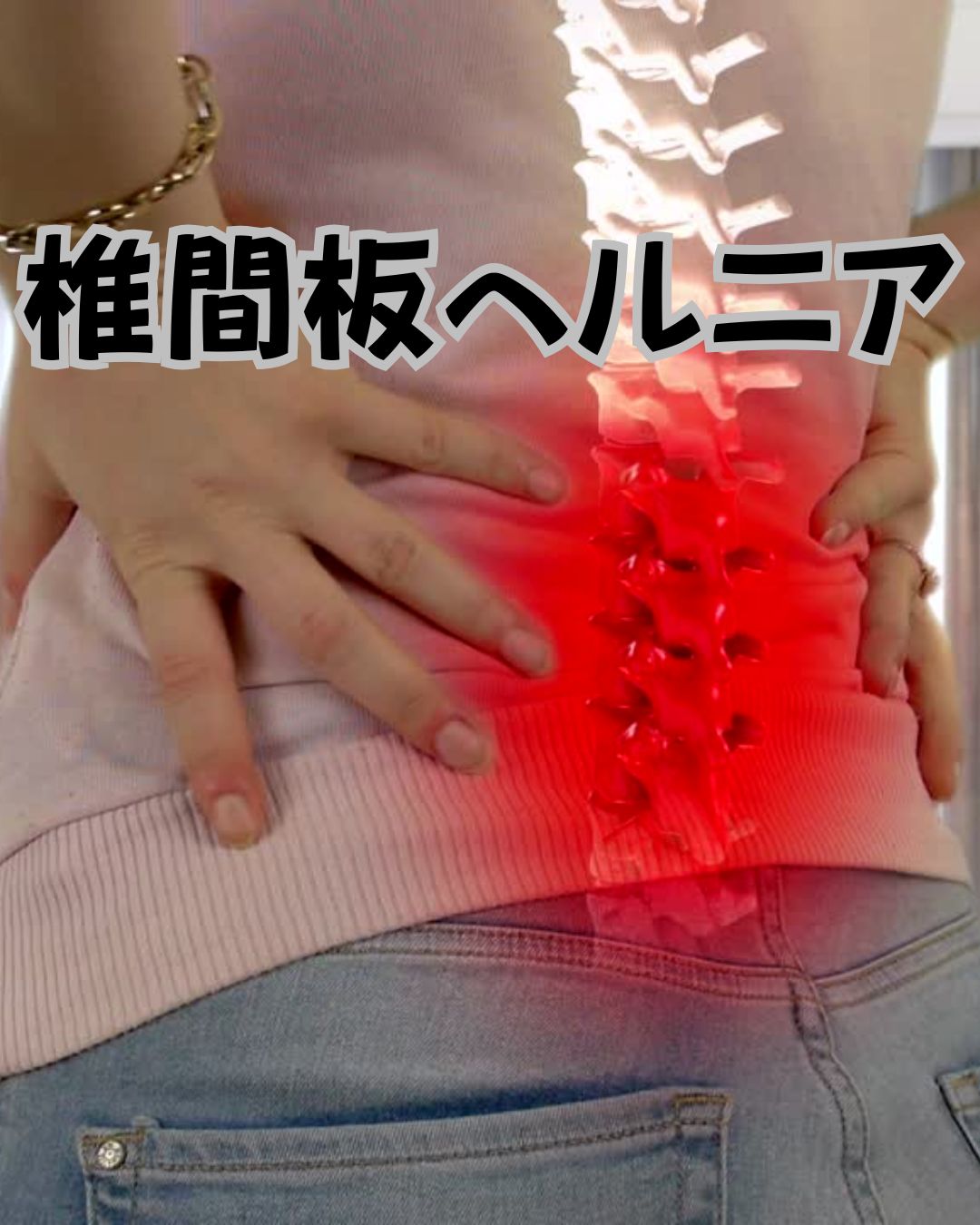 ヘルニア