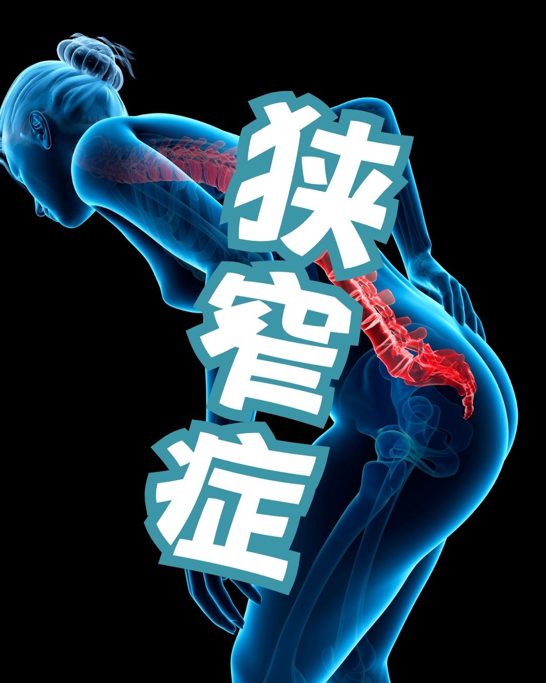 狭窄症　年配者に多い腰痛　年配者