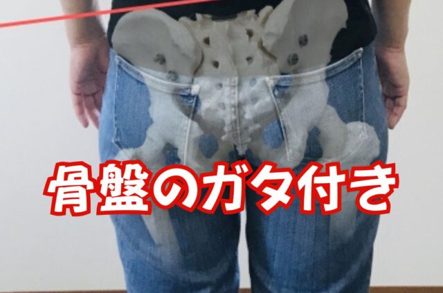 産後骨盤矯正　骨盤のガタ付き　骨盤