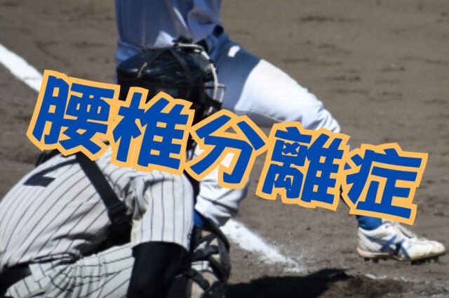 腰椎分離症